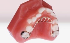 نمونه دستگاه داخل دهانی