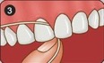 کاربرد نخ دندان
