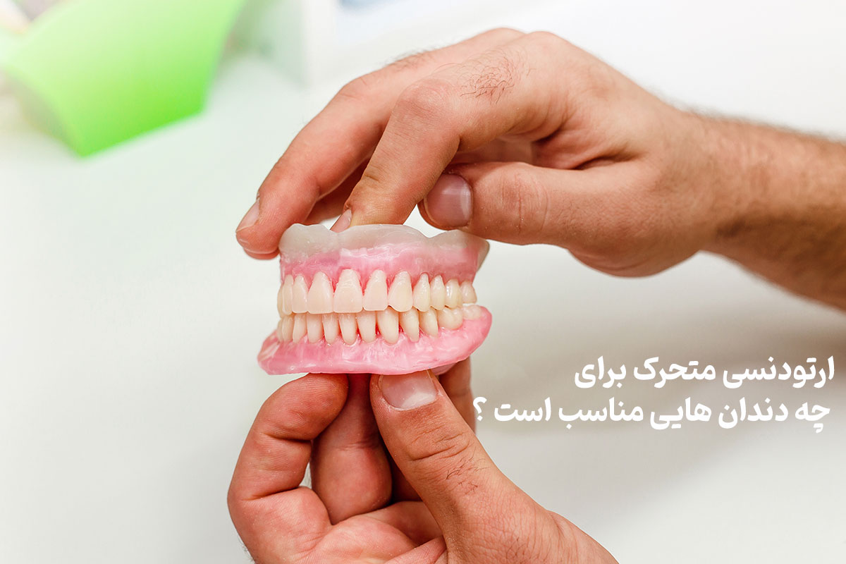 ارتودنسی متحرک برای چه دندان هایی مناسب است؟