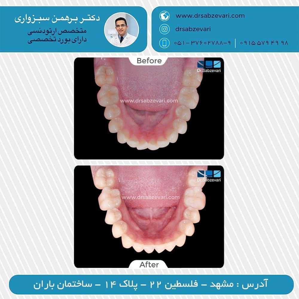 Sample-orthodontic-treatment